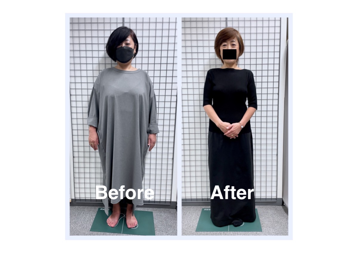 サプリ不要の耳つぼダイエット／春日部市｜一ノ割駅徒歩8分